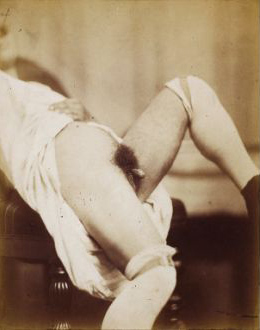 Hermaphrodite, 1860 - Felix Nadar